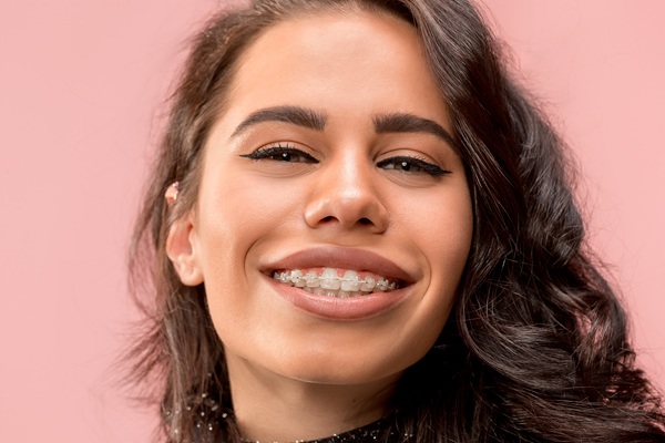 FAQs About Clear Braces Treatment