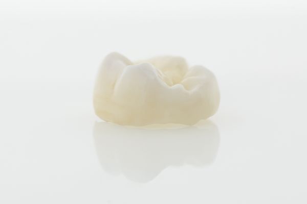 General Dentistry: How Dental Crowns Can Safeguard Your Teeth