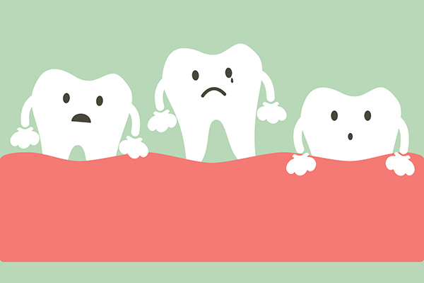 Ask A General Dentist: How Do I Deal With A Loose Tooth?