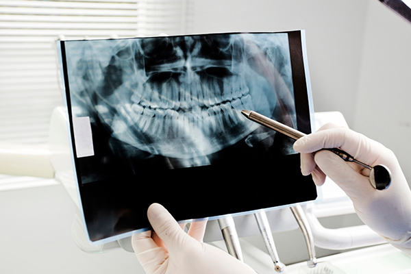 General Dentistry: Benefits Of Digital X Rays