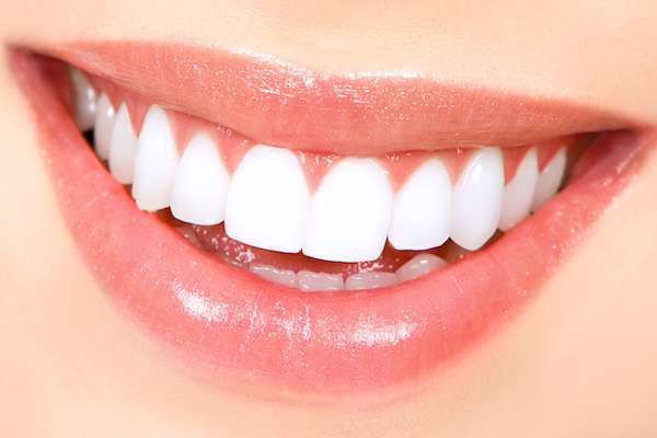 How Long Does Teeth Whitening Take from Paramount Dental Care & Specialty in Long Beach, CA