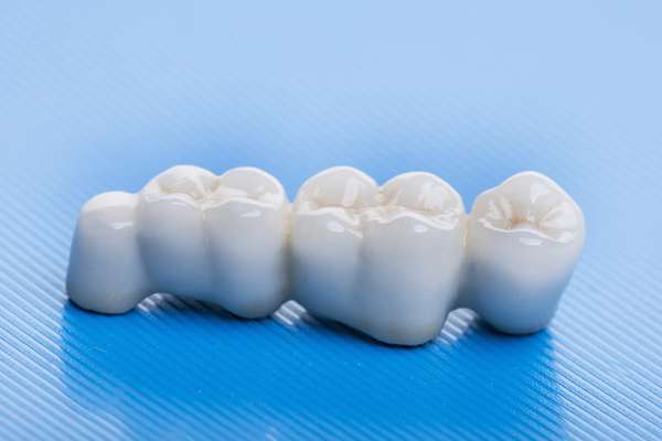 How Many Teeth Can Dental Bridges Replace from Paramount Dental Care & Specialty in Long Beach, CA