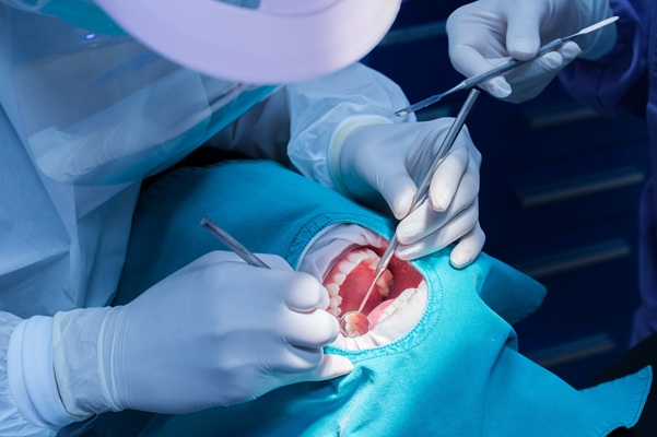 Oral Surgery Options From A General Dentist