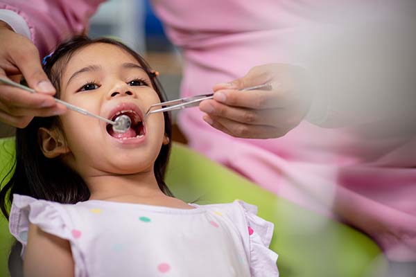 Important Pediatric Dental Services