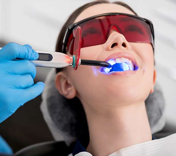 Long Beach Professional Teeth Whitening