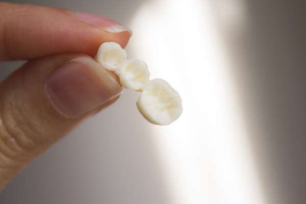 Replace Missing Teeth with Dental Bridges from Paramount Dental Care & Specialty in Long Beach, CA