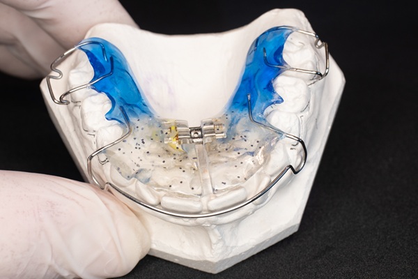 Retainers: Why They Are Essential For Maintaining A Straight Smile