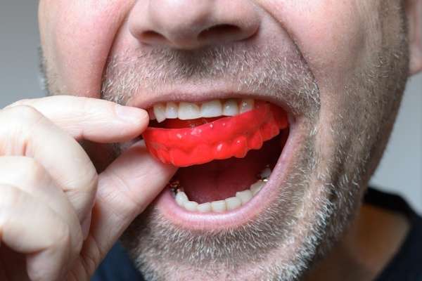 Save Your Teeth by Wearing Mouth Guards at Night from Paramount Dental Care & Specialty in Long Beach, CA