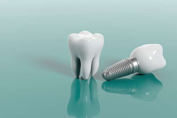 Multiple Teeth Replacement Options: One Implant for Two Teeth from Paramount Dental Care & Specialty in Long Beach, CA