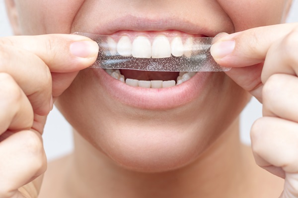 The Effectiveness Of Take Home Teeth Whitening Trays